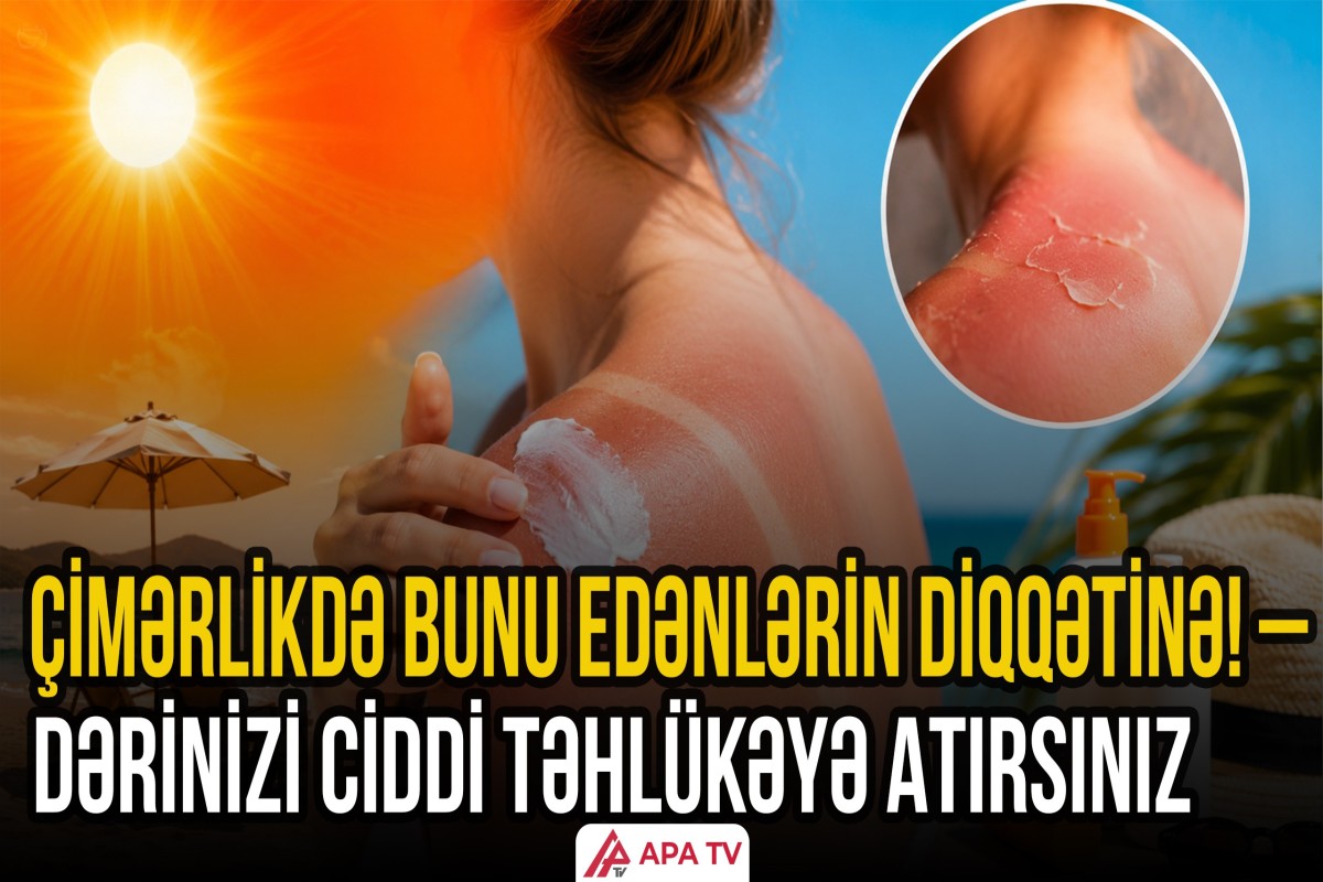 Günəş şüaları xərçəngə səbəb ola bilər? - Dermatoloqdan ŞOK XƏBƏRDARLIQ