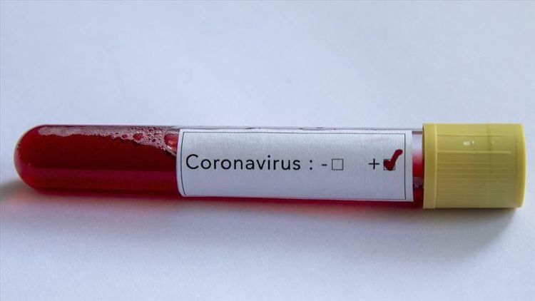 Niderlandda son sutkada koronavirusdan 164 nəfər vəfat edib