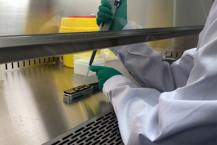 Rusiyada 20 dəqiqə ərzində koronavirus aşkarlayan test sistemi hazırlanıb
