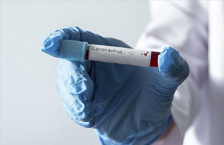 Global cases of coronavirus exceed 1 mln. 700 thousand