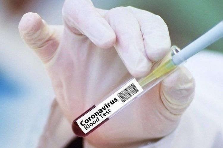 Kazakhstan reports 11th coronavirus death   - UPDATED