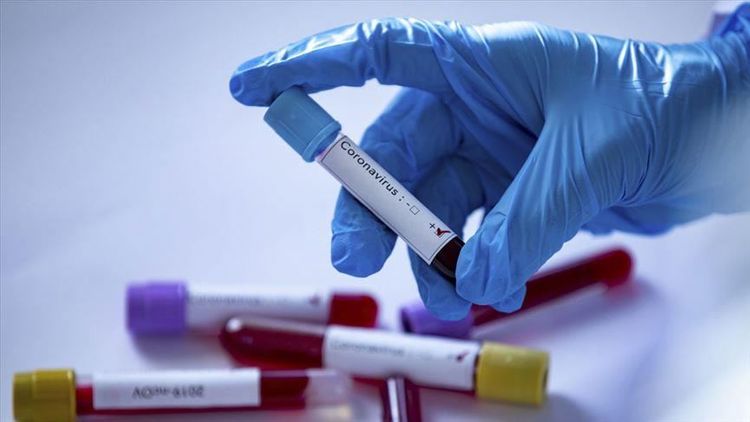 Nazir: “Avstriyada 14 416 nəfər koronavirusa yoluxub”
