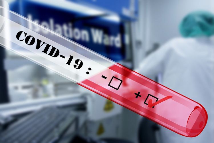 İspaniyada koronavirusdan ölənlərin sayı 20 mini ötüb