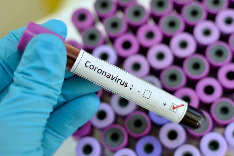 Over 2.1 million COVID-19 tests conducted in Russia