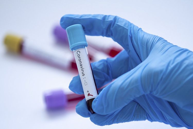 Qazaxıstanda koronavirusdan 20 nəfər dünyasını dəyişib