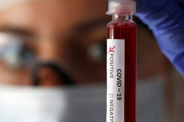 Италия начнет испытания вакцины против COVID-19 на людях летом