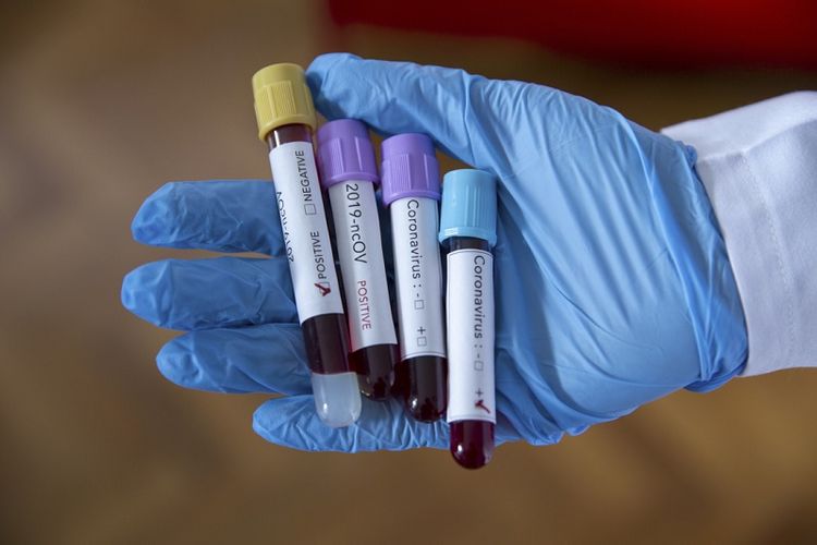 Kazakhstan records 45 new coronavirus cases, total settling at 2,334  