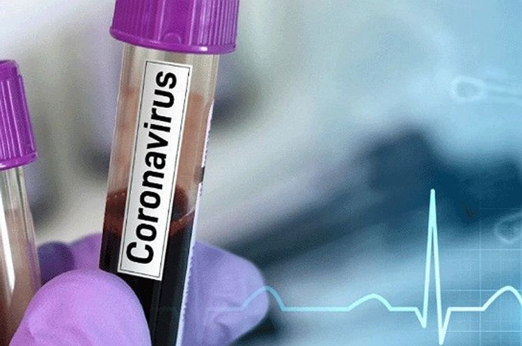 Coronavirus cases in Armenia grow by 65 in past 24 hours, making total number 1,932