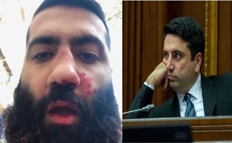 Ermənistan Parlamentinin vitse-spikeri müxalifətçi bloqeri döyüb