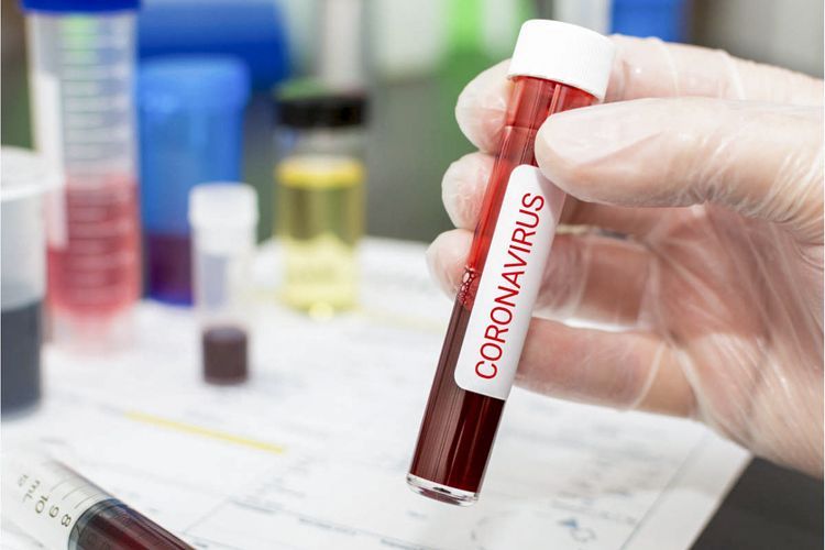 В Германии коронавирусом за сутки заразились 955 человек