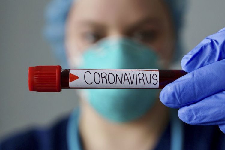 Armenia records 233 coronavirus cases over past day