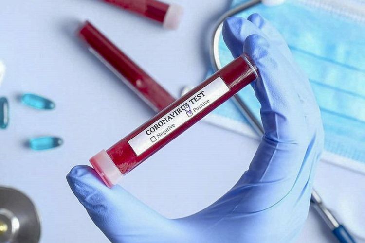 766 179  coronavirus tests conducted in Azerbaijan