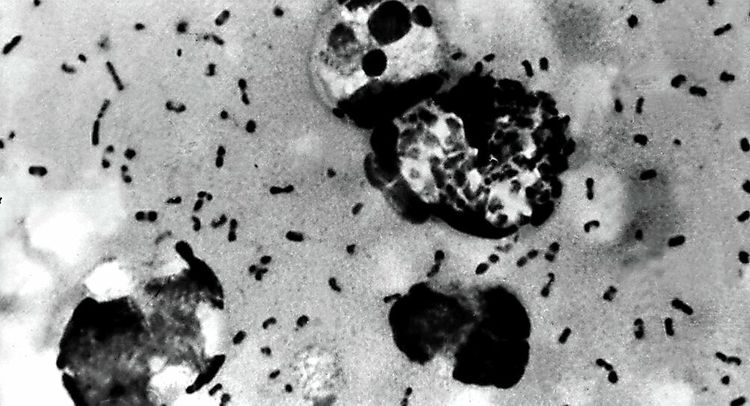 Bubonic plague kills 2 in inner Mongolia, forces Chinese officials to close off area