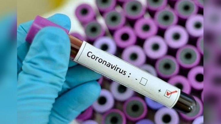 Kazakhstan reports 722 new coronavirus cases, 100,164 in total