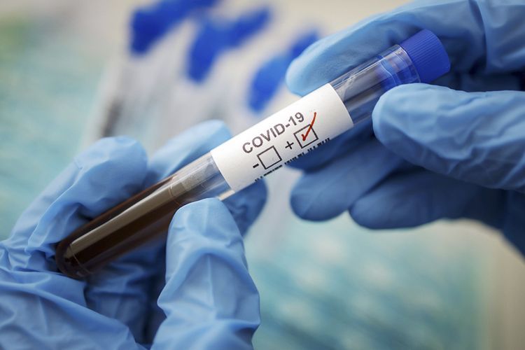 В России за последние сутки коронавирусом заразились еще 4 892 человека