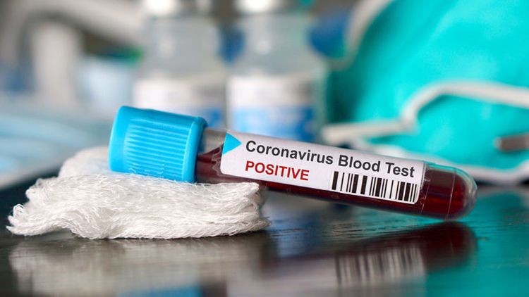 Kazakhstan expects new wave of coronavirus in October