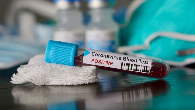 Number of confirmed coronavirus cases reaches 36,435 in Azerbaijan, 534 deaths