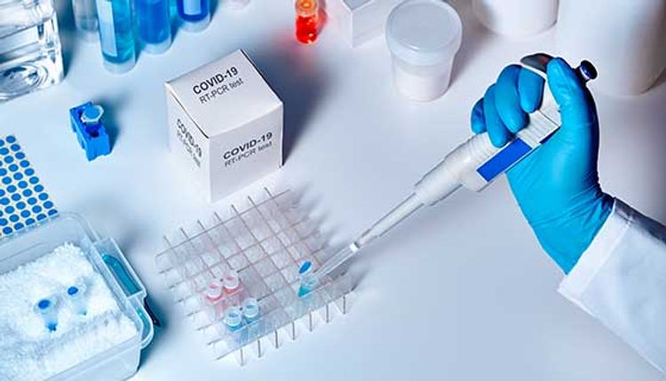  1,884,578 coronavirus tests conducted in Azerbaijan so far