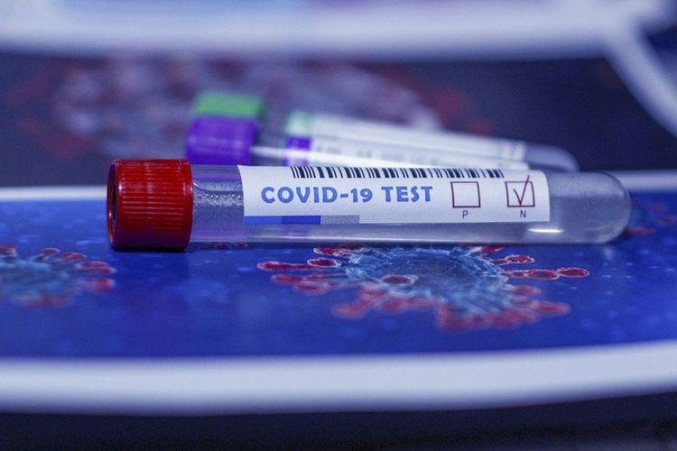 В Азербайджане до сегодняшнего дня проведено 2 049 239 тестов на коронавирус