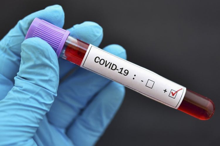 Ukraine records over 1 mln COVID-19 cases since beginning of pandemic