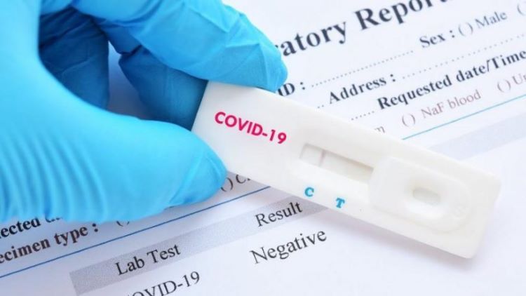 Германская компания намерена экспортировать в Азербайджан тесты на коронавирус