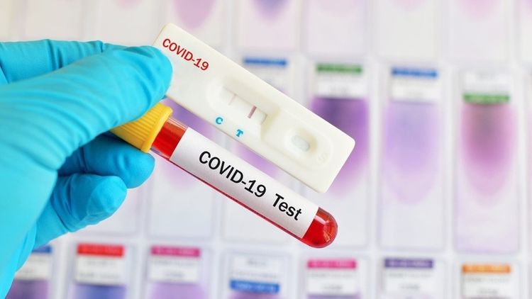 Kyrgyzstan reports 361 new cases of coronavirus, 8,847 in total