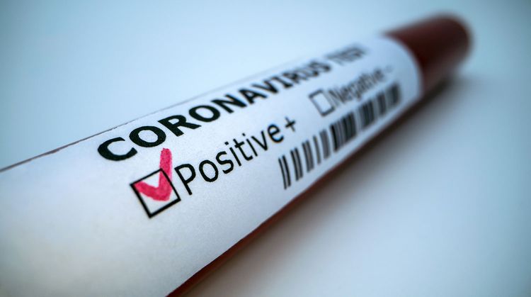 В США создали прибор мгновенного выявления коронавируса