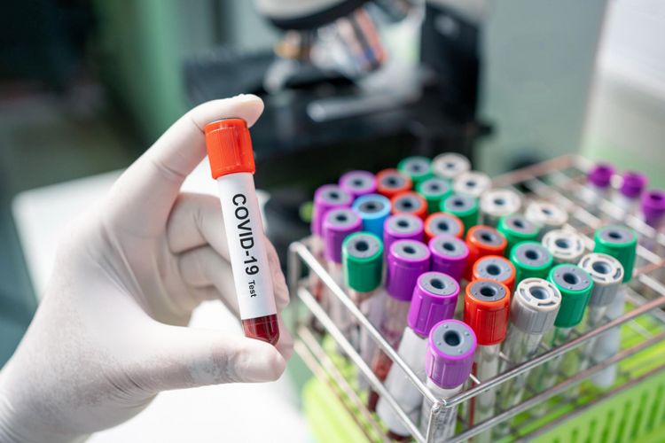ÜST: Koronavirusa qarşı 25 namizəd peyvənd insan sınaqları mərhələsindədir