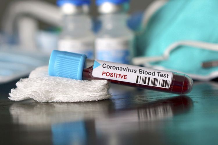 İranda son sutkada koronavirusa ən yüksək yoluxma qeydə alınıb