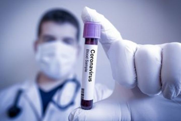 Number of confirmed coronavirus cases in Azerbaijan reach 6860, with 3871 recoveries and 82 deaths