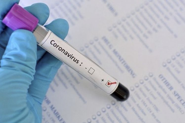 Ukraynada koronavirusdan ölənlərin sayı 777-yə çatıb