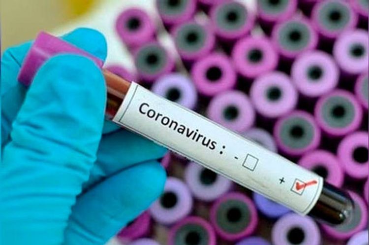 Number of coronavirus cases in Armenia reach 13,325
