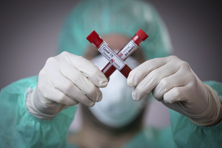 За сутки в США от коронавируса умерли 794 человека