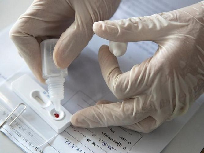 Australian state extends state of emergency as coronavirus cases spike