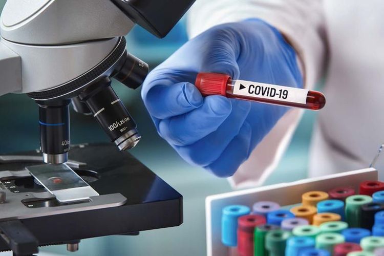 Kazakhstan adds new COVID-19 cases, total at 19,750  