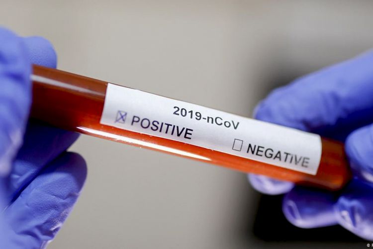 ABŞ-da bir sutkada koronavirusdan 2 515 nəfər ölüb