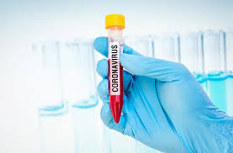 Jordan confirms first coronavirus case 