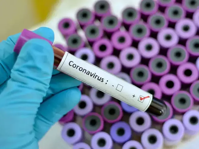 Gürcüstanda koronovirusa yoluxanların sayı 4-ə çatıb