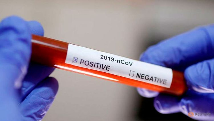 В Италии от коронавируса за сутки умерли 36 человек