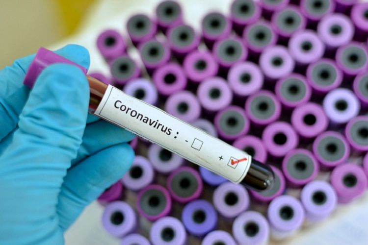 Jamaica confirms first imported case of coronavirus
