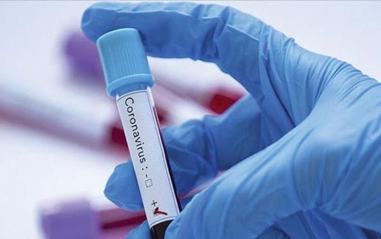 Coronavirus cases in Russia rise to 147