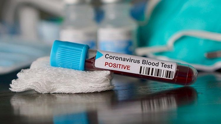 TƏBİB: Koronavirus testinin şəxsi istəyə bağlı olunmaması tövsiyə olunur