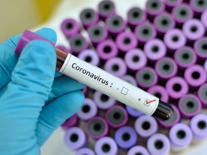 İsveçrədə 3438 nəfər koronavirusa yoluxub, 33 nəfər ölüb