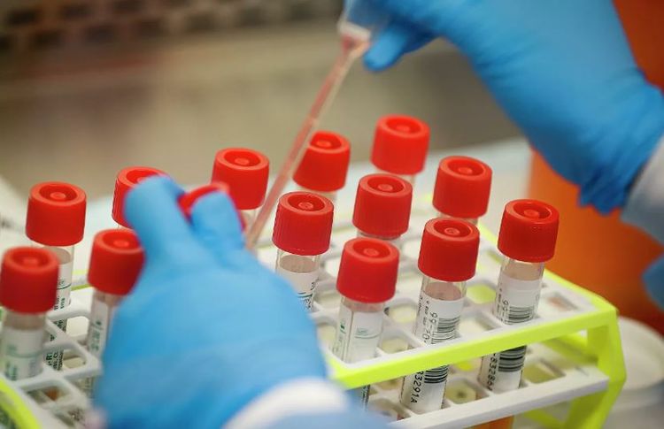 ABŞ-da bir həftədə ana və üç uşağı koronavirusdan ölüb