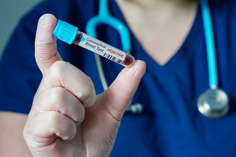 9,444 health workers tested positive to coronavirus in Spain