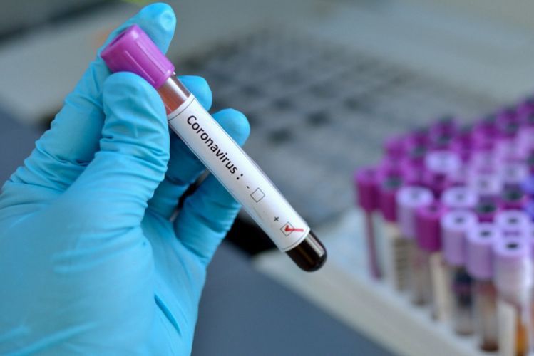 UK health minister tests positive for coronavirus