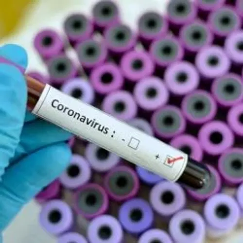 Coronavirus outbreak: Confirmed cases in Pakistan rise to 1,563