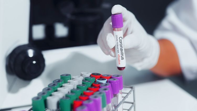 Russia conducts almost 4 million coronavirus tests
