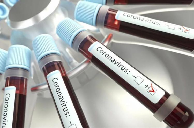 Kazakhstan confirms 3,964 coronavirus cases  
