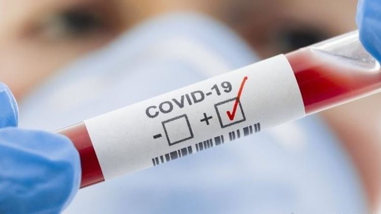 Kazakhstan announces 11 more COVID-19 cases, 4834 in total